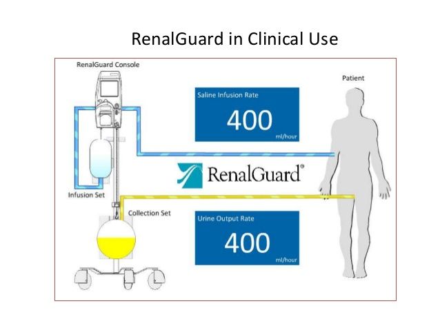 cin # renalguard-the-kidneys-are-nowhere-near-the-heart-6-638